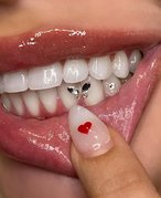 What You Should Know Before Getting Tooth Gems
